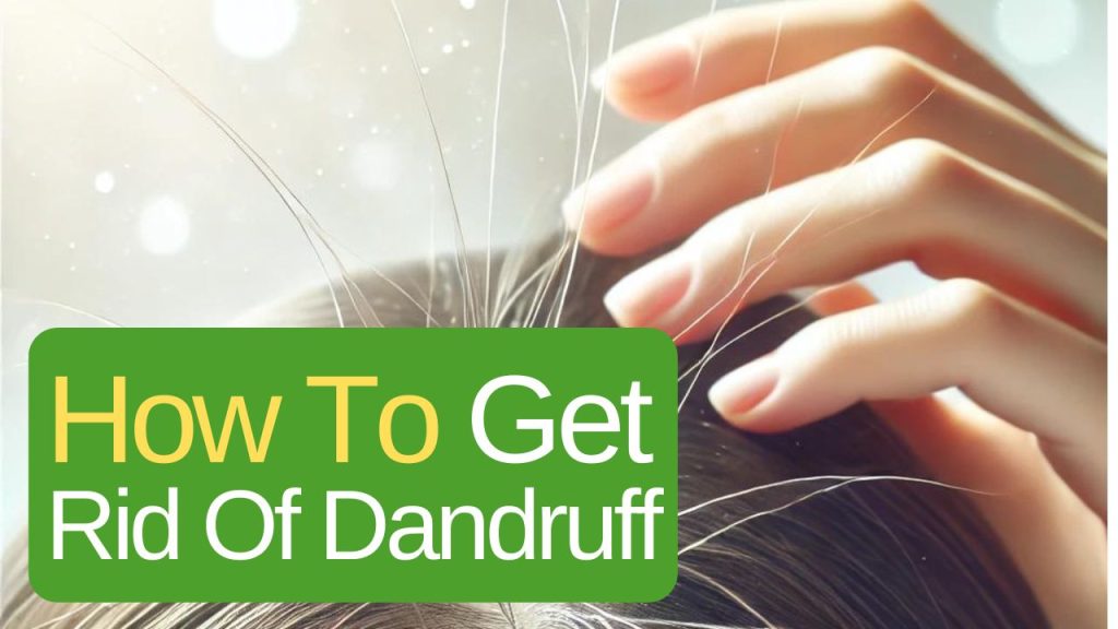How To Get Rid Of Dandruff